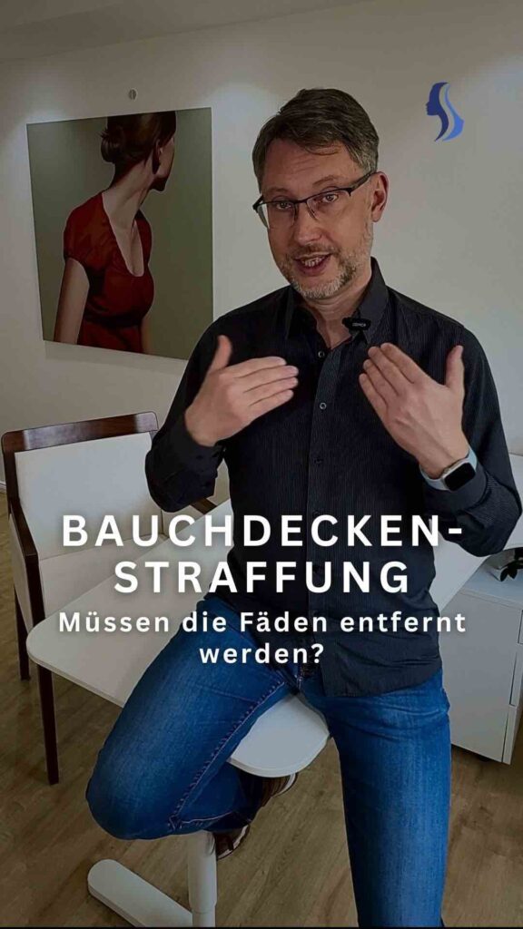 Müssen nach einer Bauchdeckenstraffung die Fäden entfernt werden?