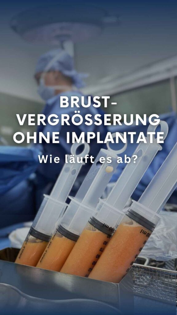 Brustvergrößerung mit Eigenfett: Ablauf der Operation