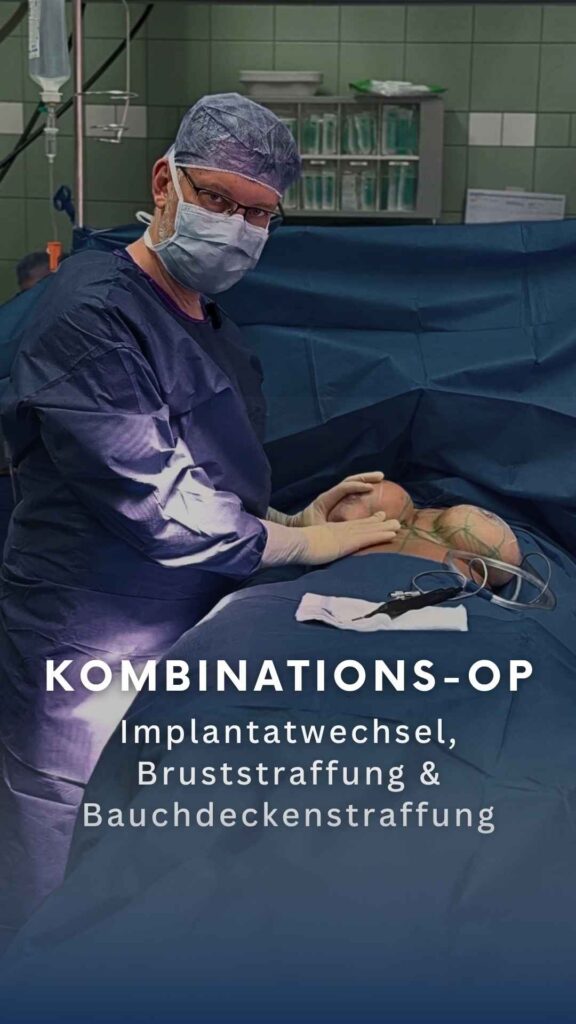 Kombinationseingriff Implantatwechsel - Bruststraffung mit Verkleinerung - Oberbauchdeckenstraffung